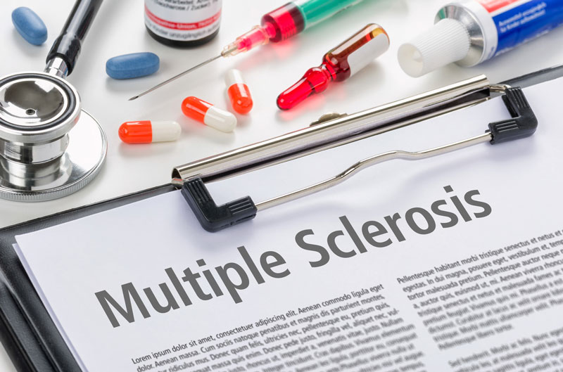 Multiple Sclerosis