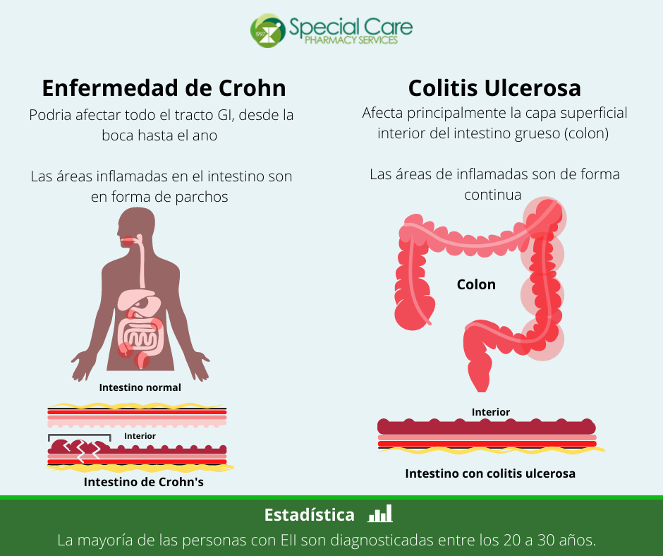 Enfermedad de Crohn y Colitis Ulcerosa
